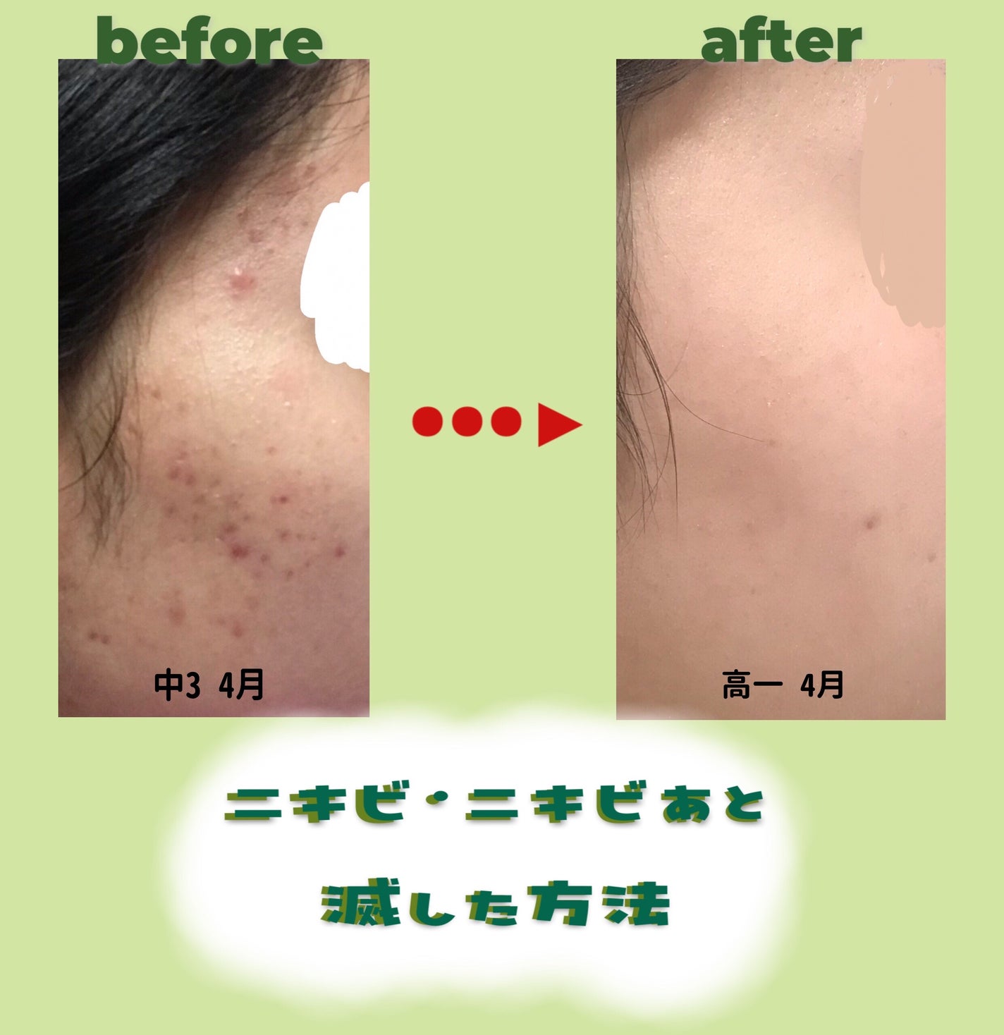 レッドブレミッシュ クリアスージングトナー/Dr.G/化粧水を使ったクチコミ(1枚目)