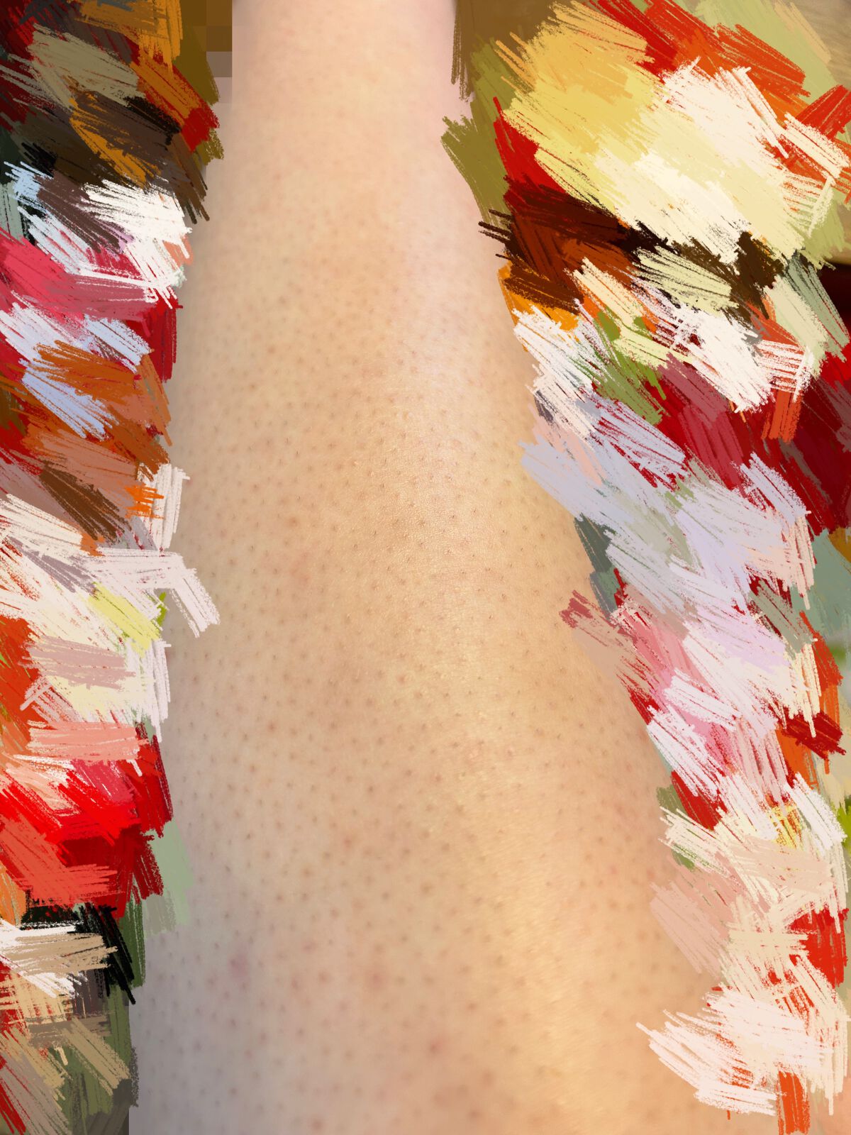 ケアノキュア（医薬品）/小林製薬/その他を使ったクチコミ（1枚目）