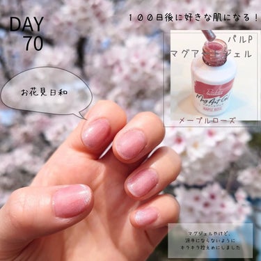 parkikoi パルP マグアートジェルのクチコミ「♡DAY70♡
【１００日後に好きな肌になるチャレンジ】

最近投稿が後ろ倒しになっております.....」（1枚目）