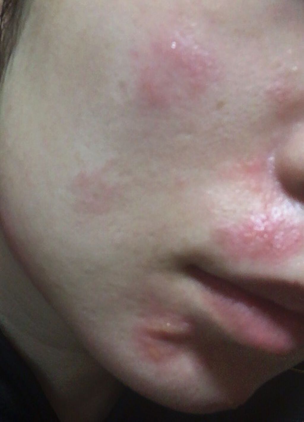 レチノールA 1% アドバンスドリバイタリゼーションクリーム/Life-flo/フェイスクリームを使ったクチコミ(2枚目)