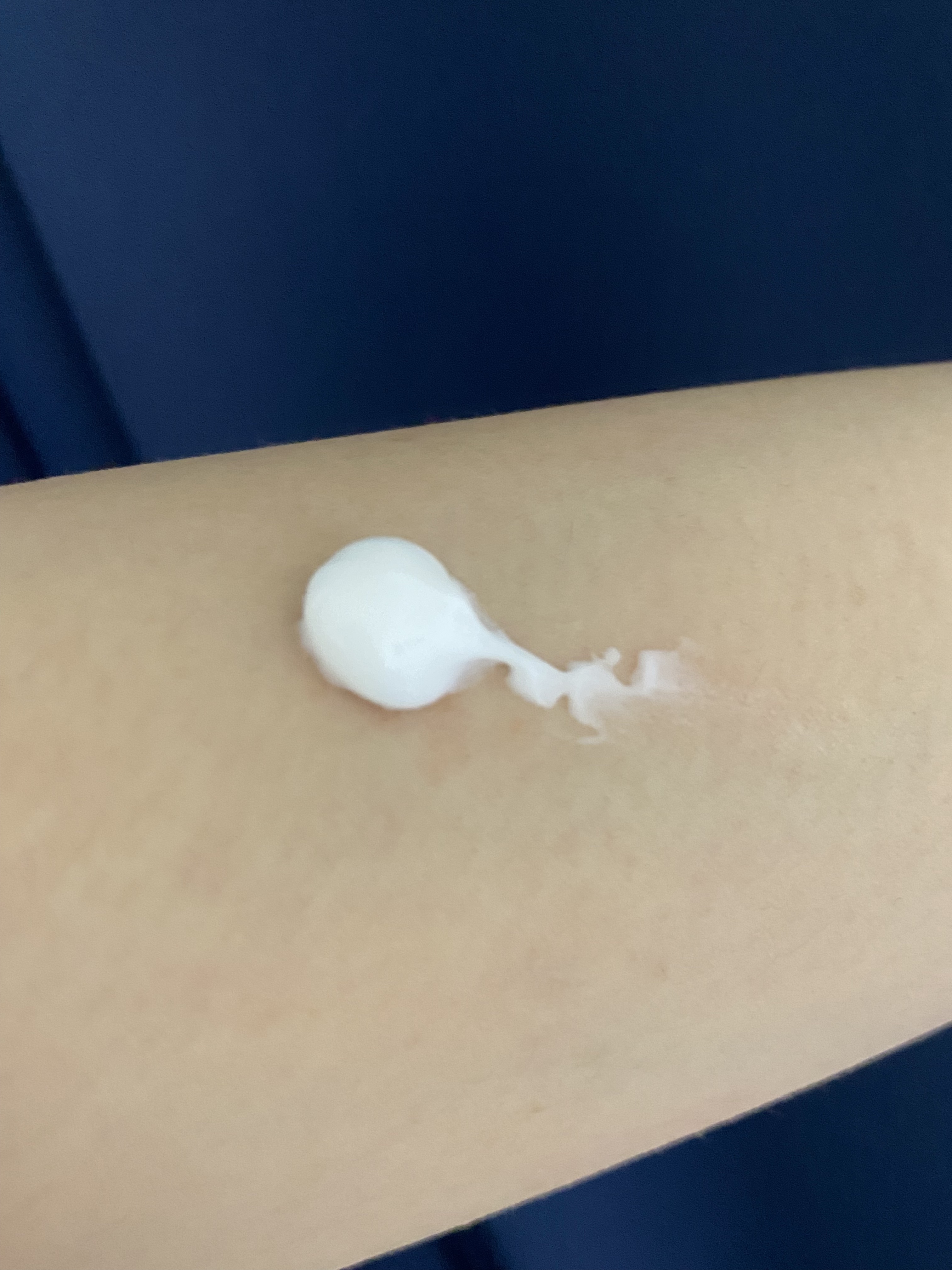 レッドスージングAIクリーム/PHYSIOGEL/フェイスオイルを使ったクチコミ（2枚目）