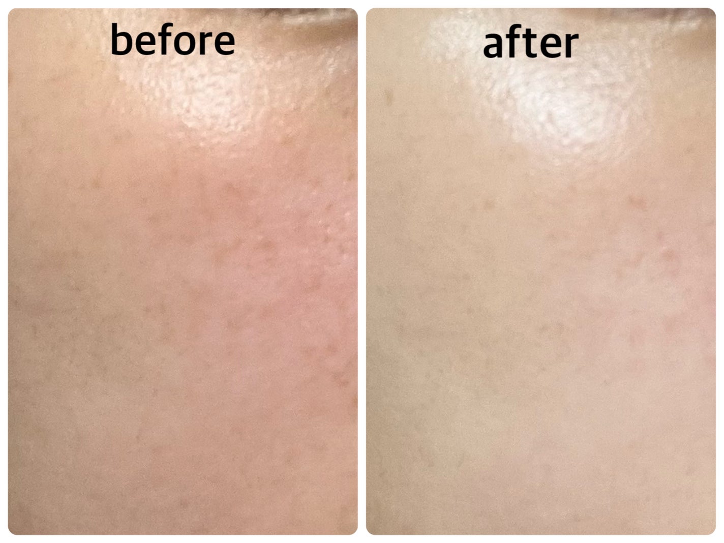 レチノール スーパーバウンス セラム/IOPE/美容液を使ったクチコミ(4枚目)