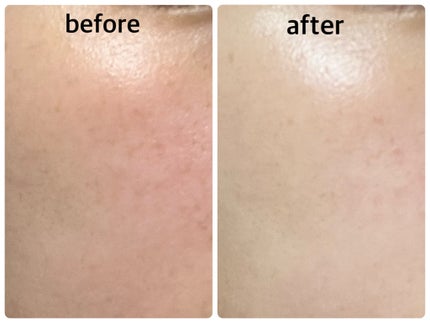 レチノール スーパーバウンス セラム/IOPE/美容液を使ったクチコミ(4枚目)