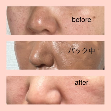 皮脂ごっそり毛穴パック/HANYUL(ハンユル)/洗い流すパック・マスクを使ったクチコミ(5枚目)