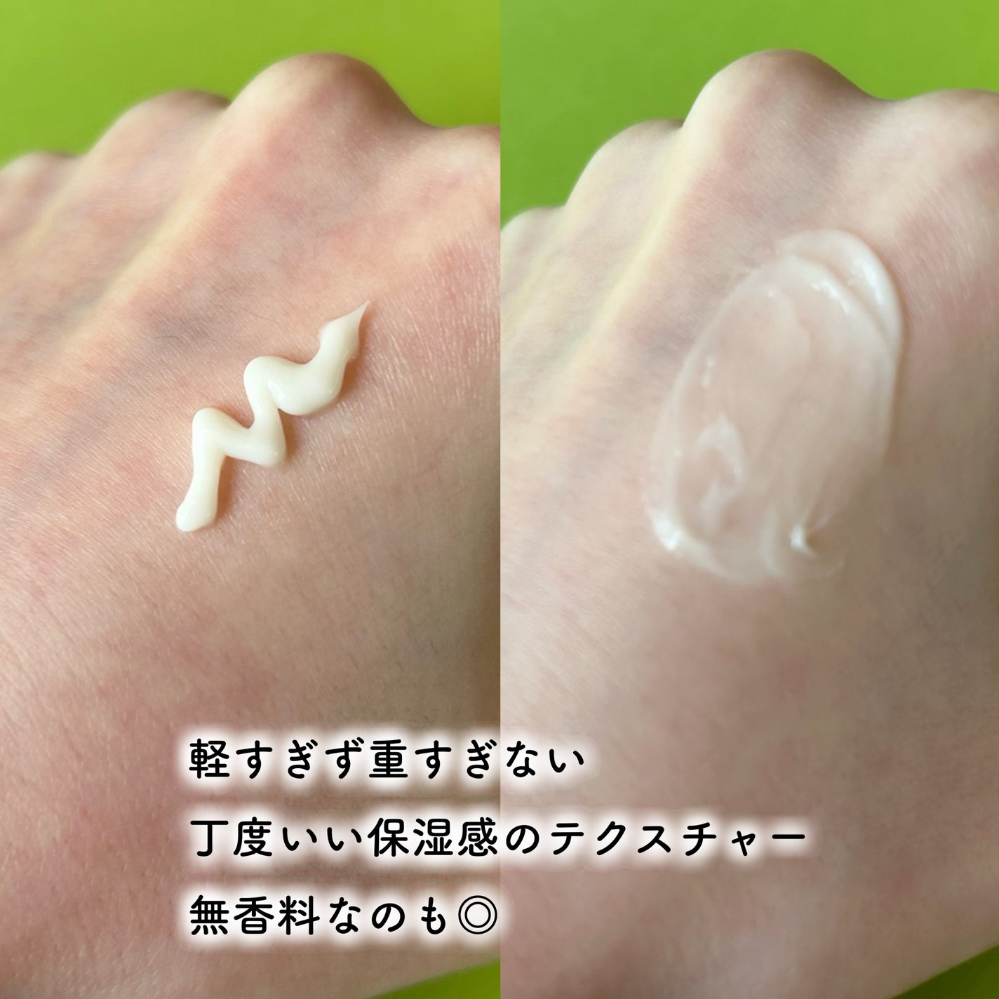 シカレチA クリーム0.05/VT/フェイスクリームを使ったクチコミ(3枚目)