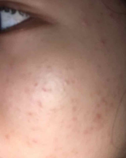 を使ったクチコミ(2枚目)