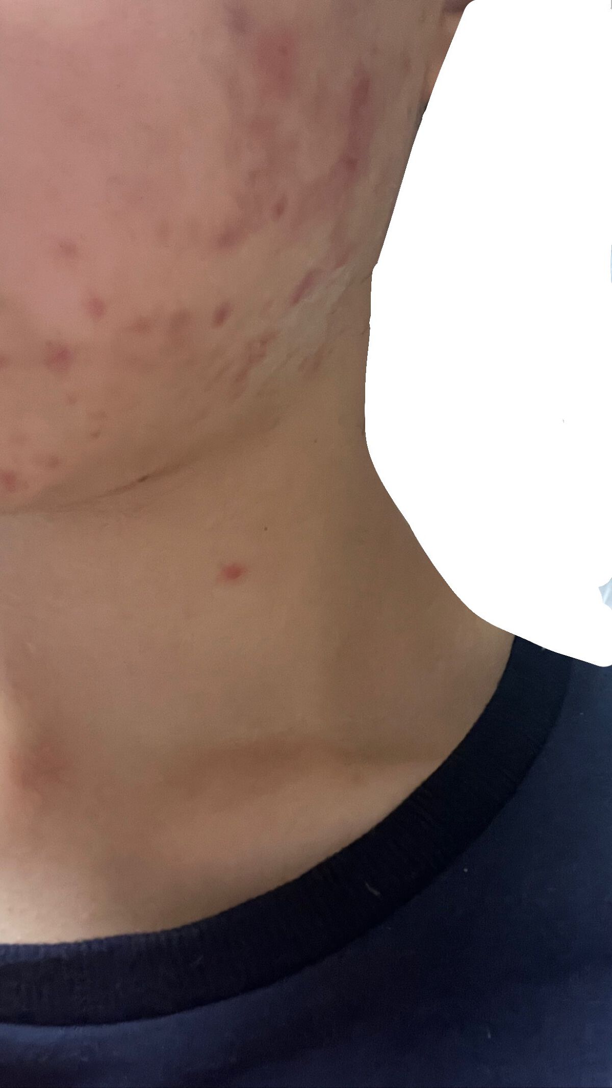 目ざまシート ボタニカルタイプ/サボリーノ/シートマスク・パックを使ったクチコミ(2枚目)