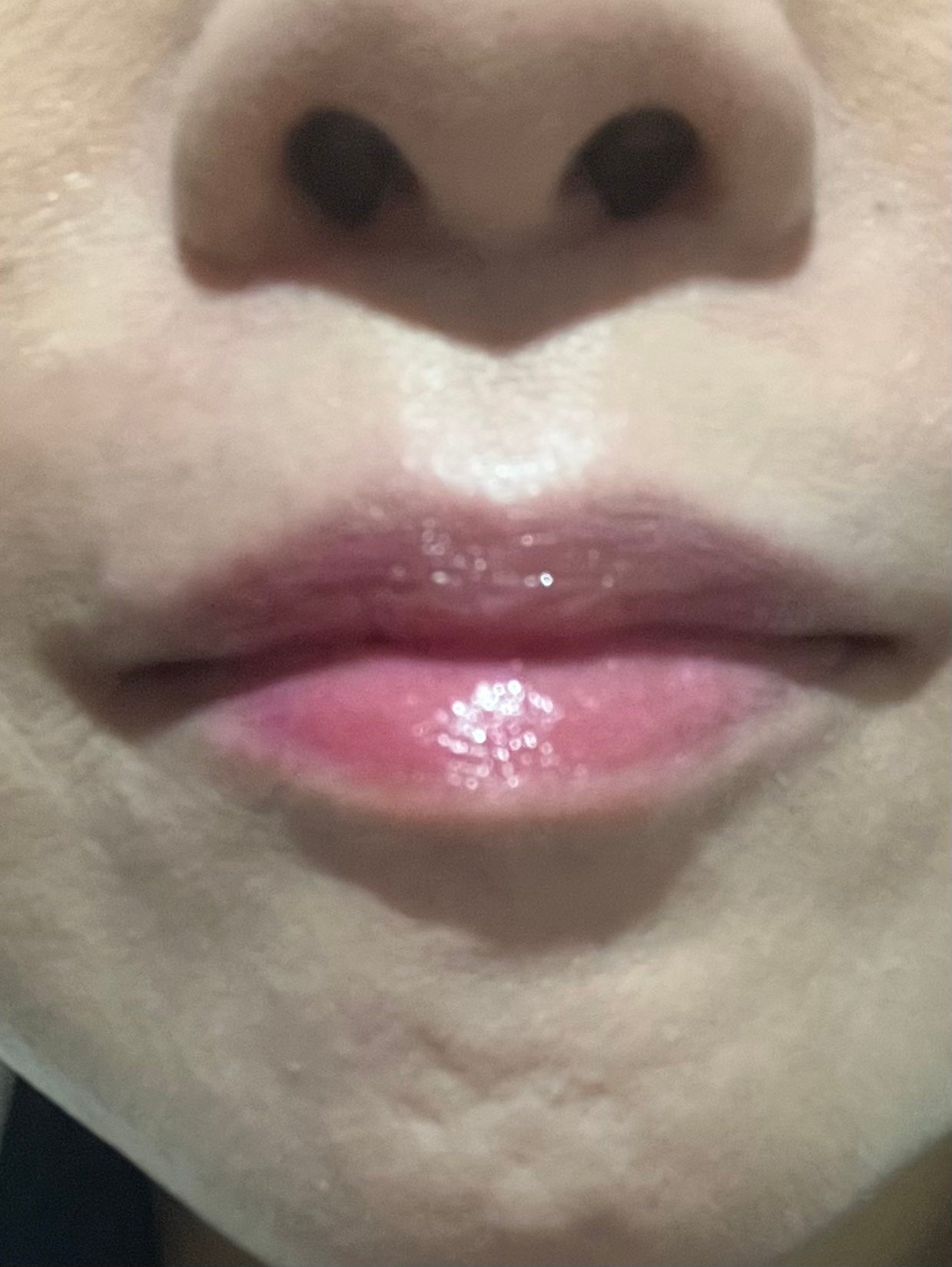 YNM キャンディーハニーリップバーム/YNM/リップバームを使ったクチコミ(6枚目)