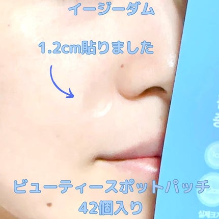 ビューティー スポットパッチ/イージーダムビューティー/にきびパッチを使ったクチコミ(5枚目)