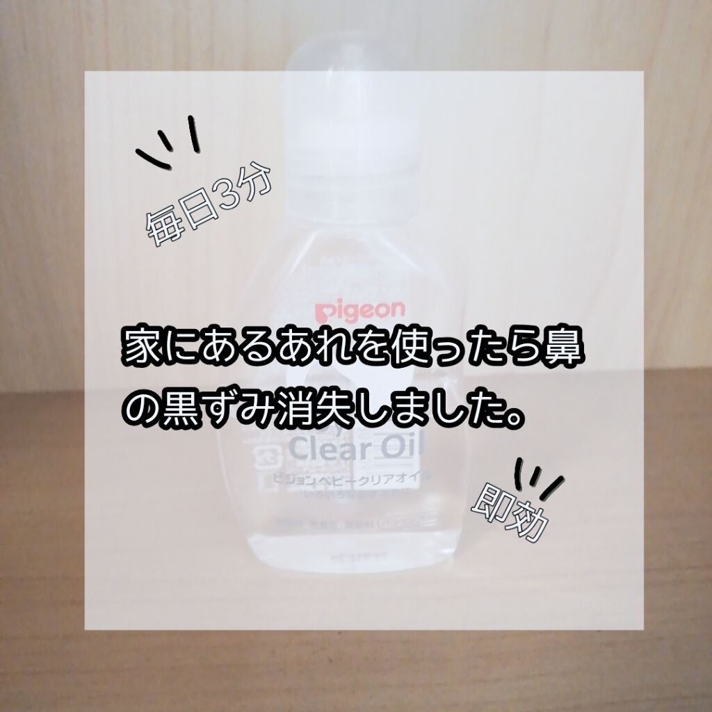 ベビーオイルR/ピジョン/ボディオイルを使ったクチコミ(1枚目)