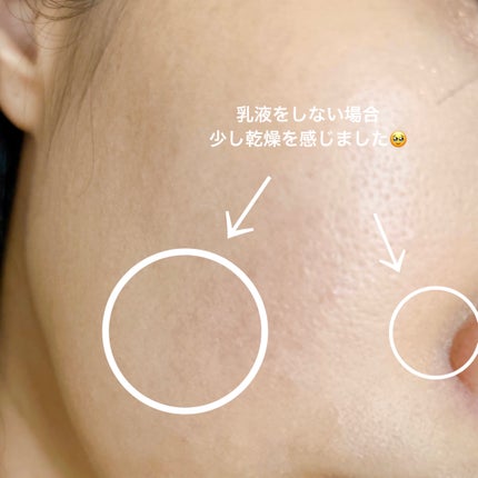 ブライト BBエッセンス/雪肌精/BBクリームを使ったクチコミ(4枚目)