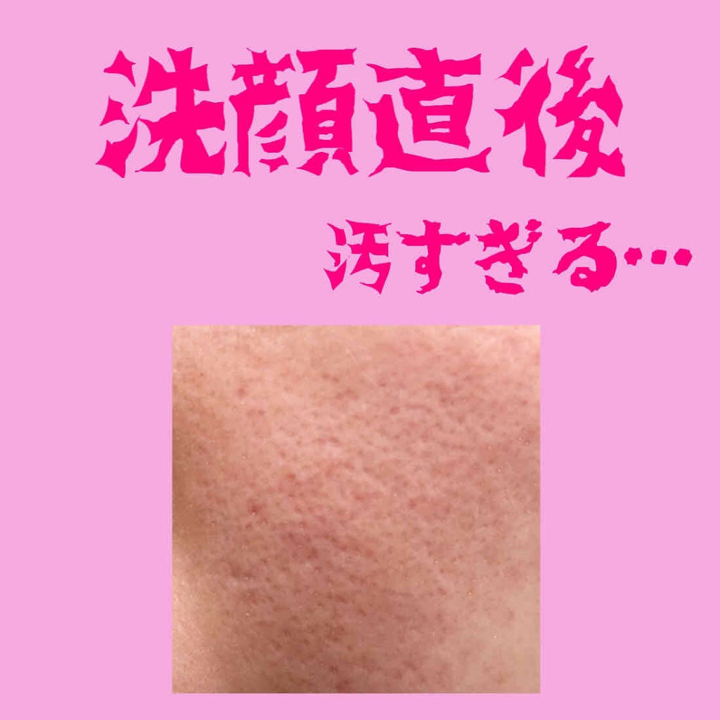 炭酸クレンジング/肌ナチュール/泡洗顔を使ったクチコミ(4枚目)