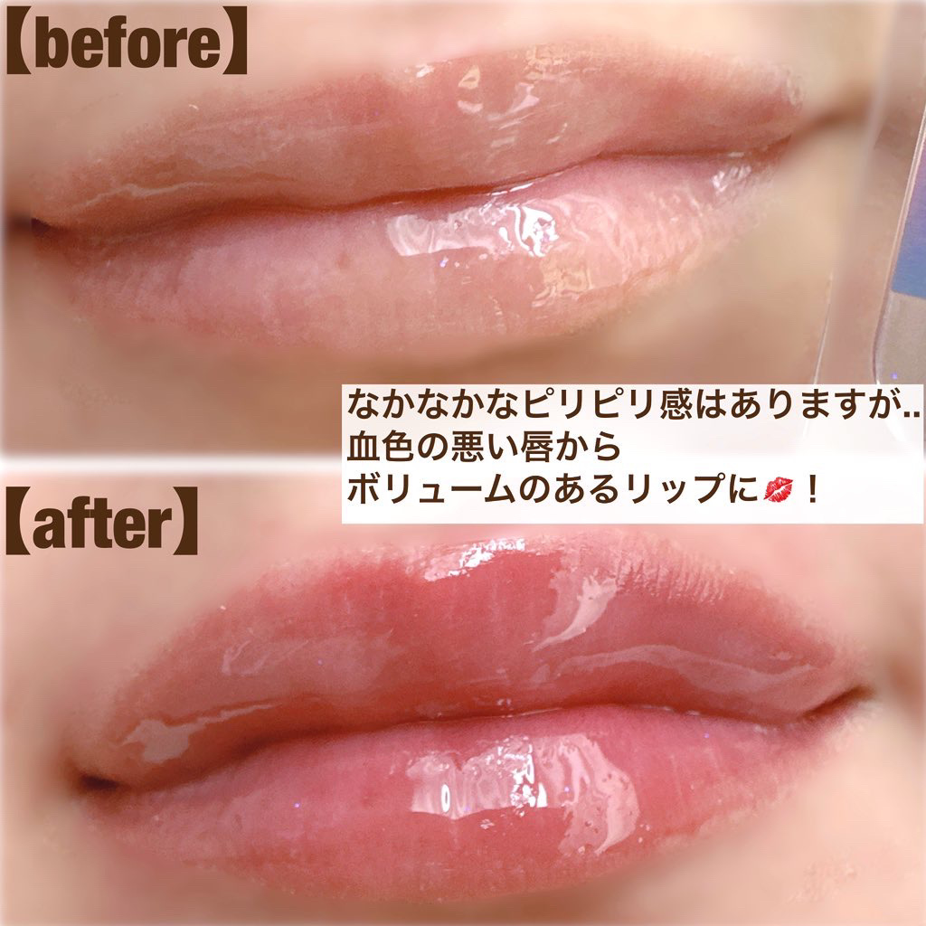 ボリュームリッププランパー/BANILA CO/リッププランパーを使ったクチコミ（3枚目）