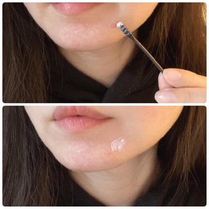 ピンクパウダースポットトリートメント/EUYIRA/その他スキンケアを使ったクチコミ(7枚目)