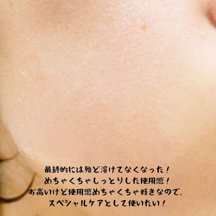 マスクフォンデュ/Quanis/シートマスク・パックを使ったクチコミ(7枚目)