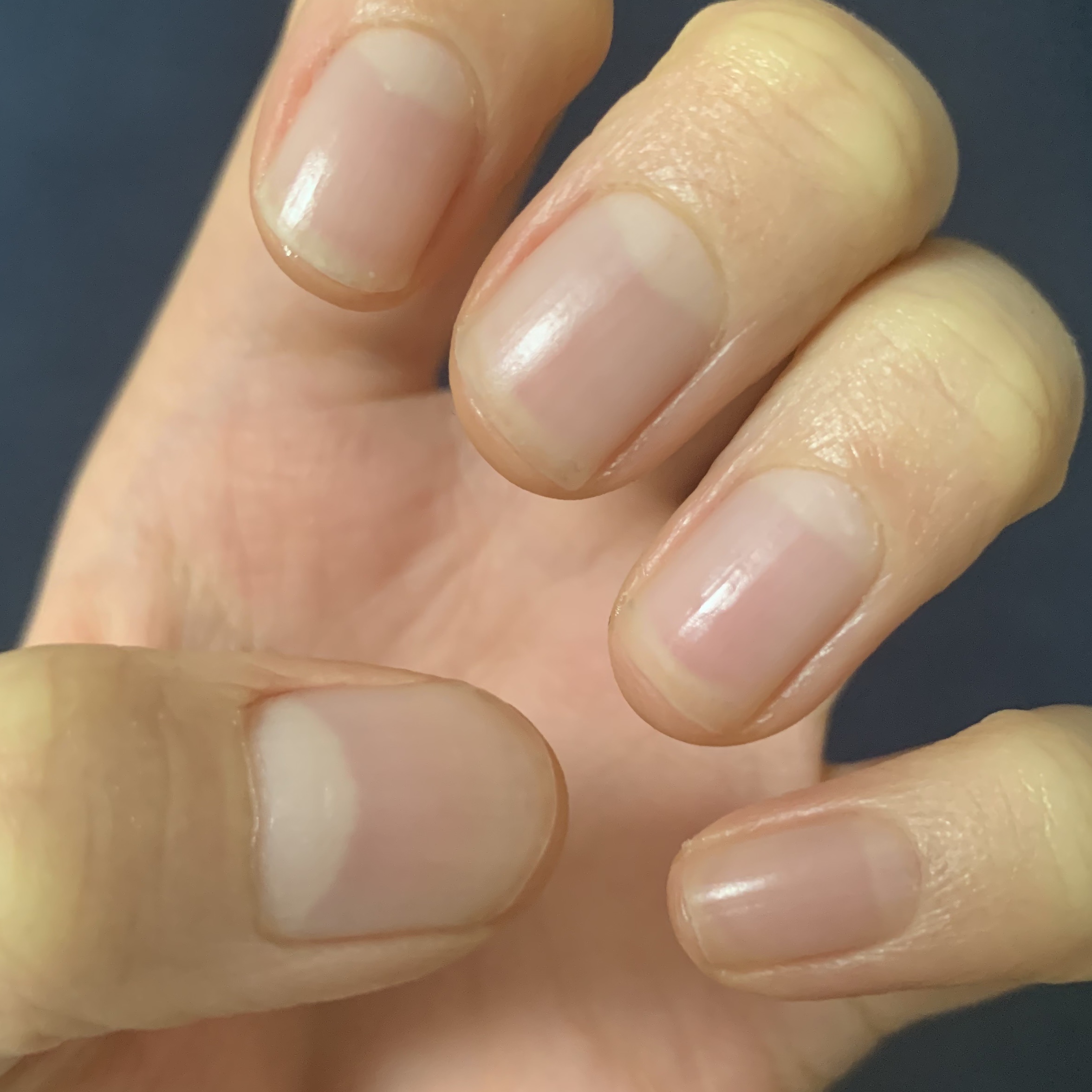 キューティクルオイル/ネイルホリック/ネイルオイル・トリートメントを使ったクチコミ（3枚目）