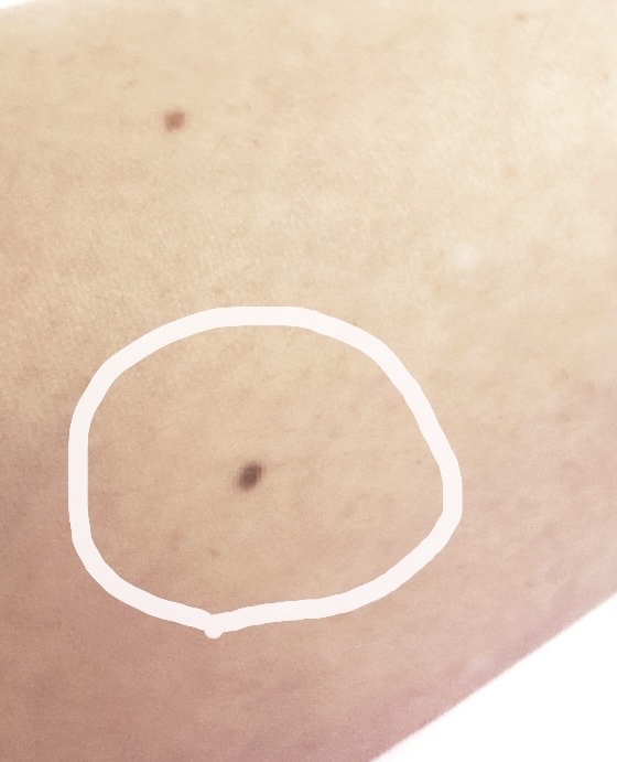 コンシーラー(シミ・ソバカス用)/グレイシィ/スティックコンシーラーを使ったクチコミ（3枚目）