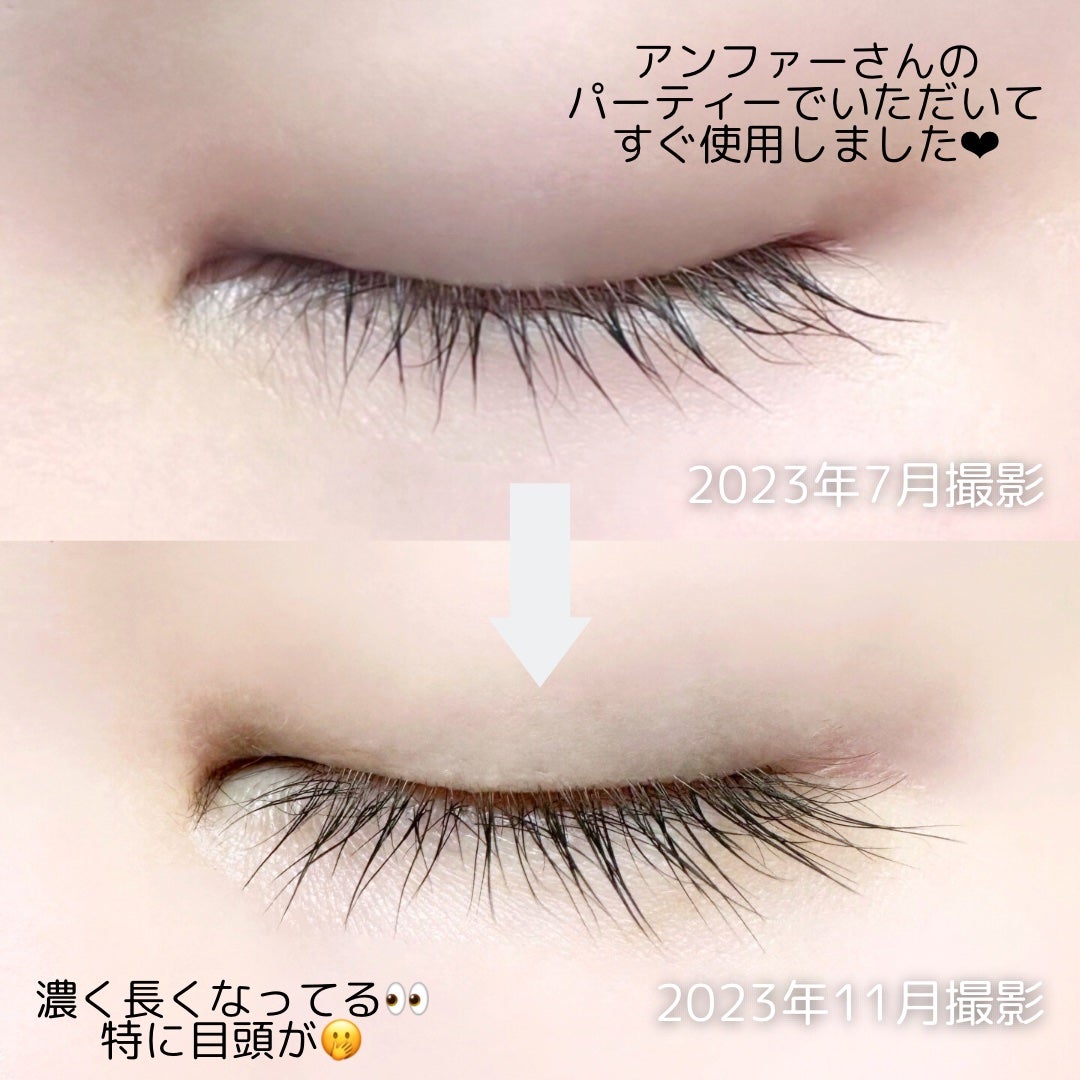 スカルプD ボーテ ピュアフリーアイラッシュセラム/アンファー(スカルプD)/まつげ美容液を使ったクチコミ(2枚目)