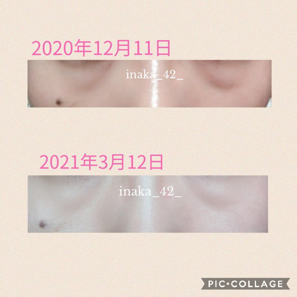 リンクルケア パッククリーム/肌美精/フェイスクリームを使ったクチコミ（2枚目）