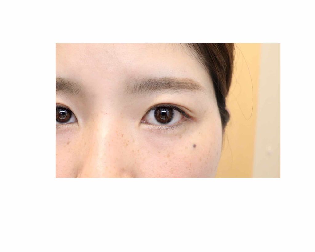 フリーファイバー120 スタンダードタイプ /メザイク/二重まぶた用アイテムを使ったクチコミ（2枚目）