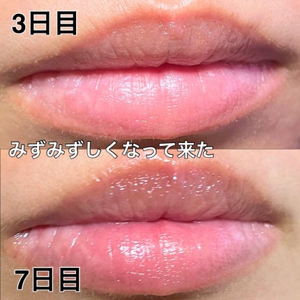 ゆーちゃか on LIPS 「どうにかしたい乾燥唇🫦プルプル唇パックでケアしてみた!・・・・..」(6枚目)
