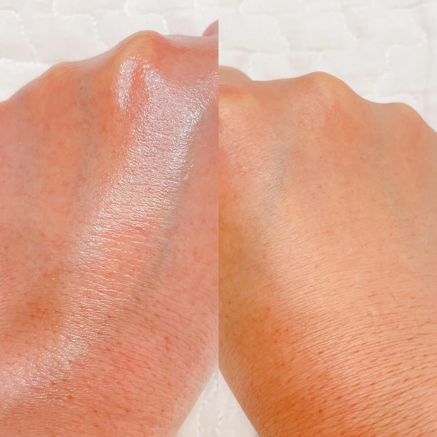 サインフォーカス ピュアアクティブ C10/エタピュール/美容液を使ったクチコミ（2枚目）