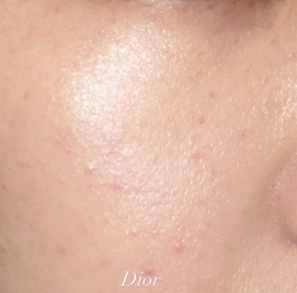 ディオールスキン フォーエヴァー フルイド グロウ/Dior/リキッドファンデーションを使ったクチコミ(5枚目)