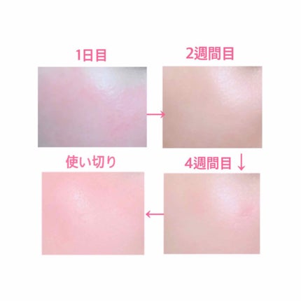 セラムラフェルミサンS/クレ・ド・ポー ボーテ/美容液を使ったクチコミ(4枚目)