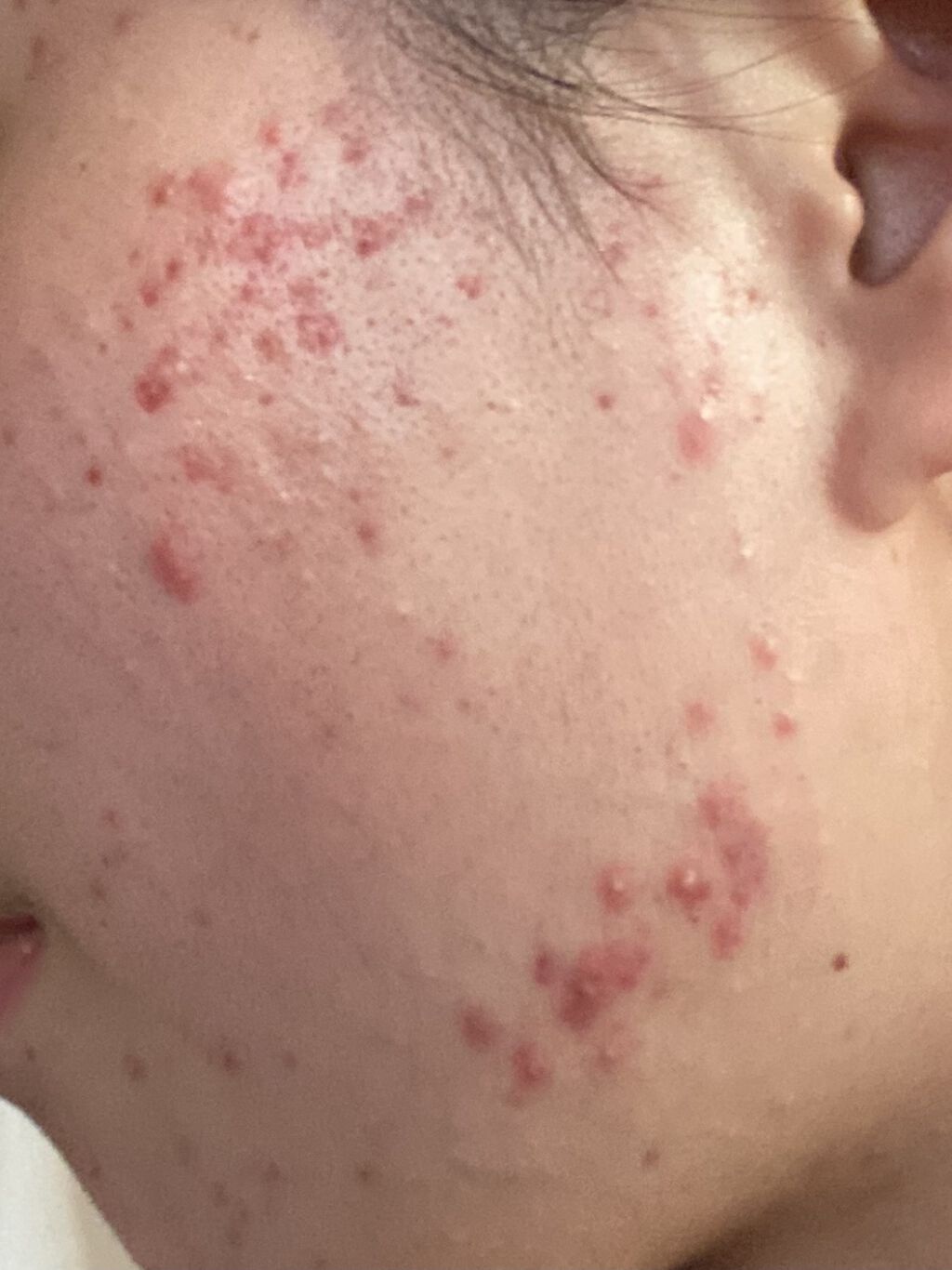 薬用しみ対策 美白化粧水 しっとりタイプ/メラノCC/化粧水を使ったクチコミ（2枚目）