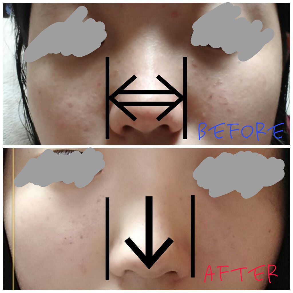 ノーズトレーナー/DAISO/その他スキンケアグッズを使ったクチコミ（3枚目）