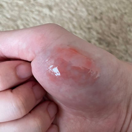 38°C / 99°F リップトリートメント (リップ美容液)/UZU BY FLOWFUSHI/リップケアを使ったクチコミ(2枚目)