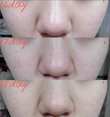 沖縄もずくのクレンジング ネオ*ちゅらびはだ/チュラコス/クレンジングジェルを使ったクチコミ(7枚目)