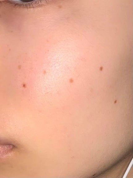 CICA ãã€ãªãŒã¹ãŒãžã³ã°ãã¹ã¯/VT/ã·ãŒããã¹ã¯ã»ããã¯ã䜿ã£ãã¯ãã³ãïŒ4æç®ïŒ