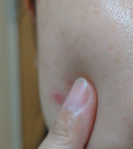 ビューティーオープナージェル リンクル&ホワイト/オージオ/美容液を使ったクチコミ(5枚目)