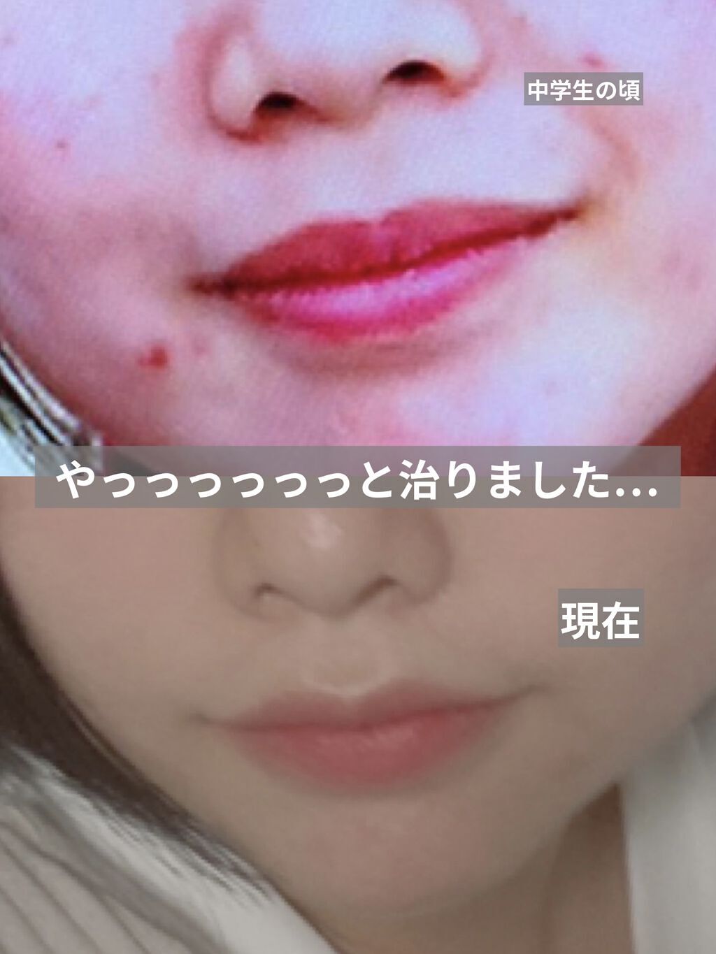 フレッシュリージュースドビタミンドロップ(35ml)/Klairs/美容液を使ったクチコミ（1枚目）