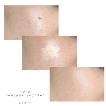 イプノス シーバムクリア リペアクリーム/ACSEINE/フェイスクリームを使ったクチコミ(8枚目)