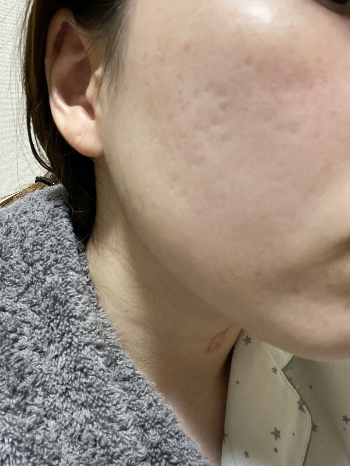 ガラクナイアシン エッセンスマスク/manyo/シートマスク・パックを使ったクチコミ（2枚目）