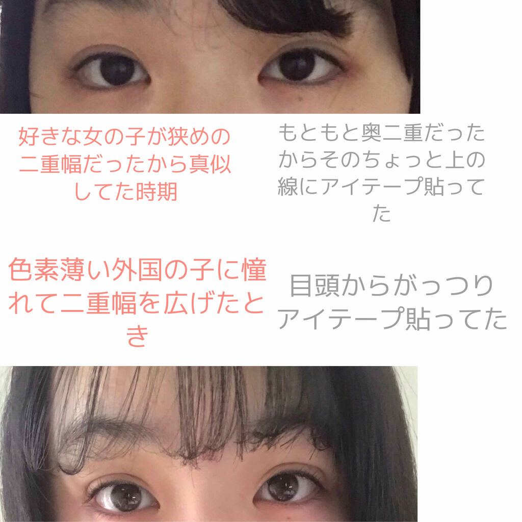 のびーるアイテープ（絆創膏タイプ、レギュラー）/DAISO/二重まぶた用アイテムを使ったクチコミ（3枚目）
