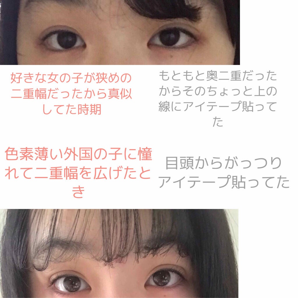 アイテープ(絆創膏タイプ、レギュラー、70枚)/DAISO/二重まぶた用アイテムを使ったクチコミ(3枚目)