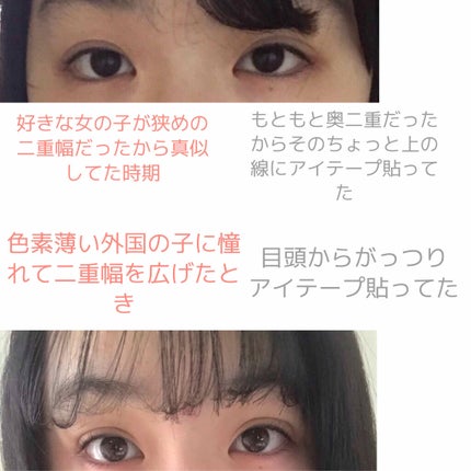 アイテープ(絆創膏タイプ、レギュラー、70枚)/DAISO/二重まぶた用アイテムを使ったクチコミ(3枚目)