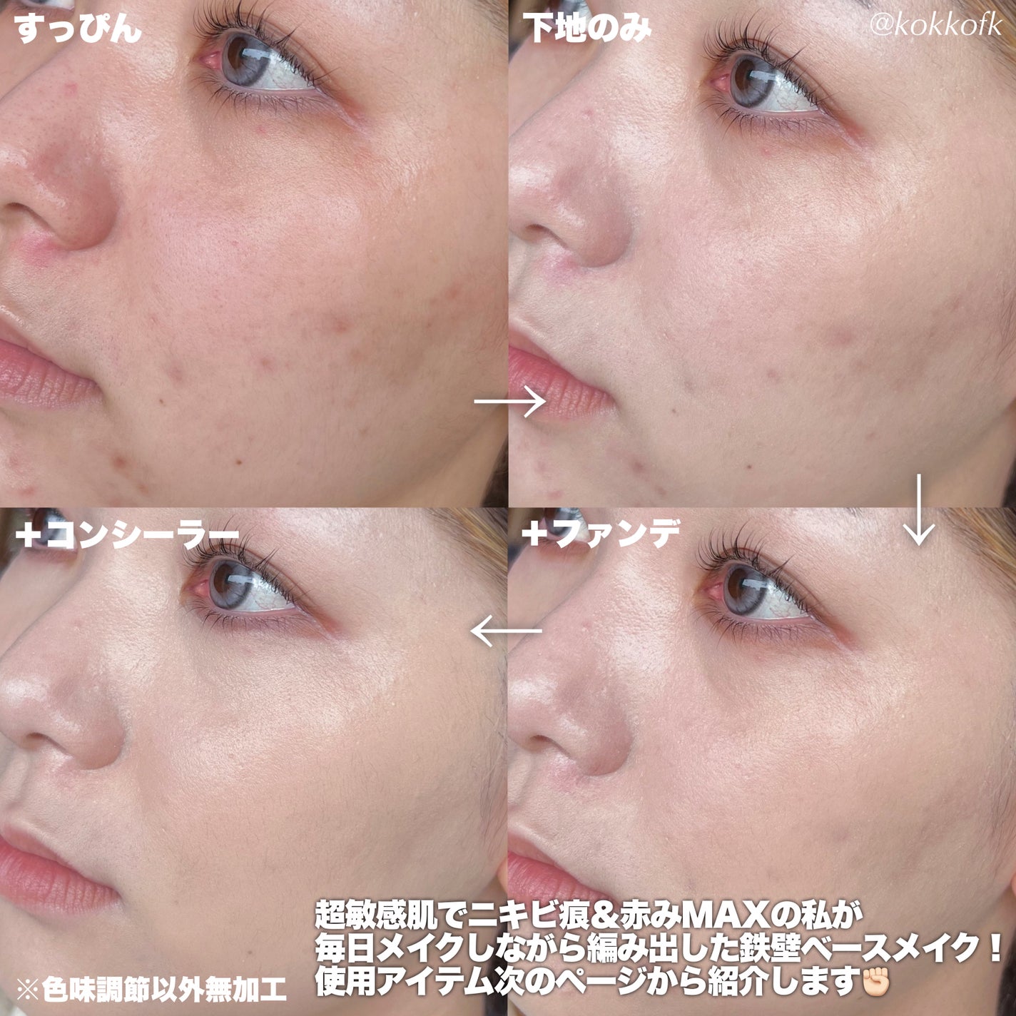 ラディアントクリーミーコンシーラー/NARS/リキッドコンシーラーを使ったクチコミ(3枚目)