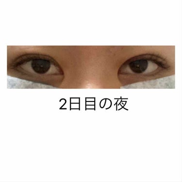 かっこいい女になりたいんだ on LIPS 「2日目の夜腫れは少し落ち着いてきた様子です手術から24時間が経..」（1枚目）