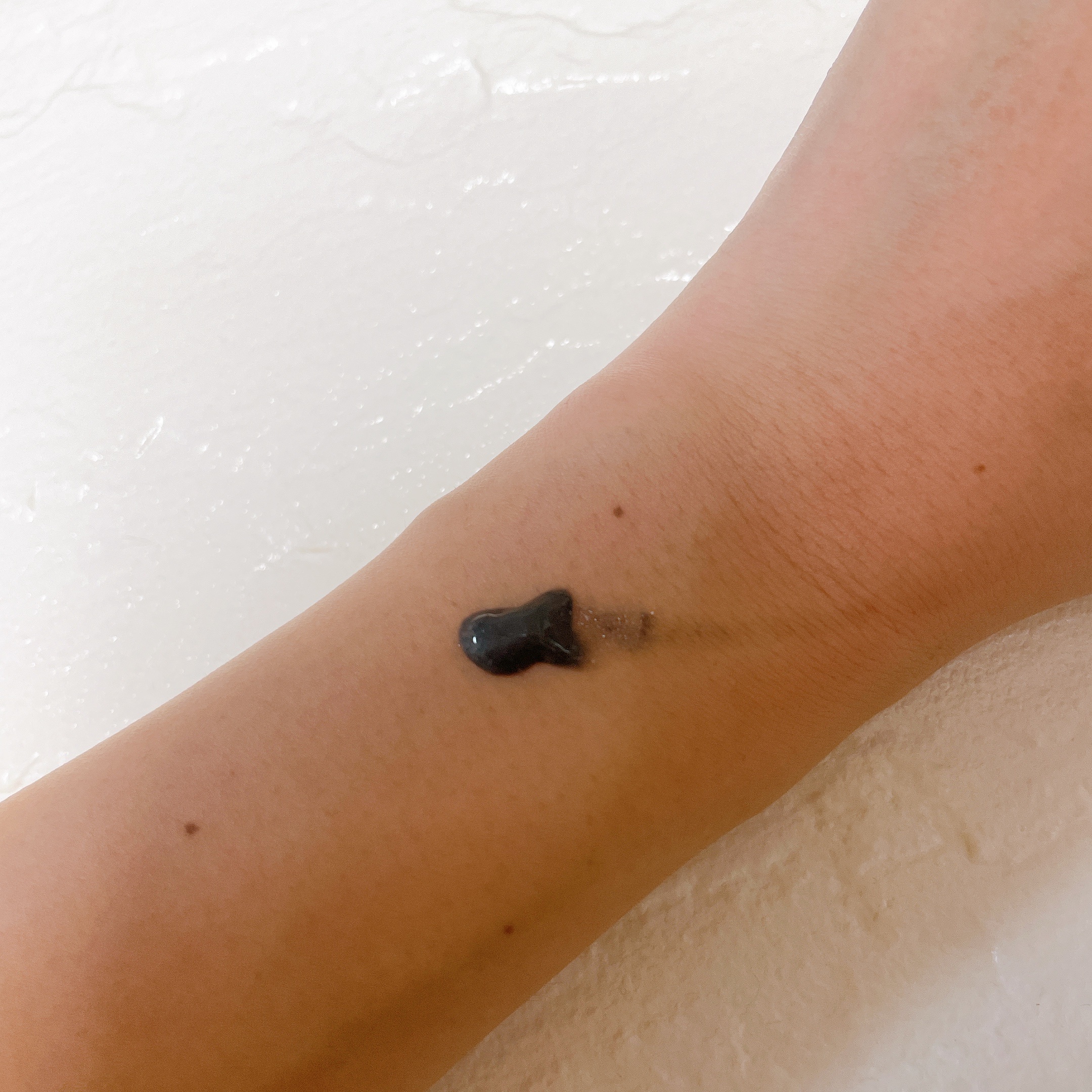 クレブラック リムーバー/グロリアス製薬/その他を使ったクチコミ（2枚目）