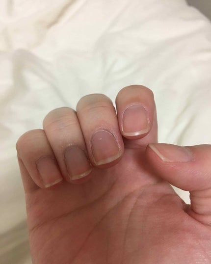 エテュセ クイックケアコート/ettusais/ネイルオイル・トリートメントを使ったクチコミ(2枚目)