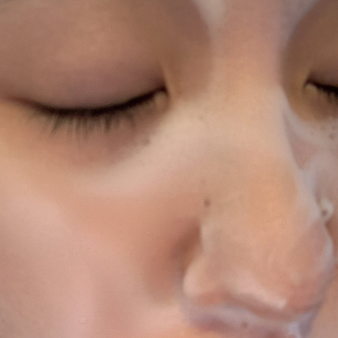 薬用化粧水/スキンライフ/化粧水を使ったクチコミ(5枚目)