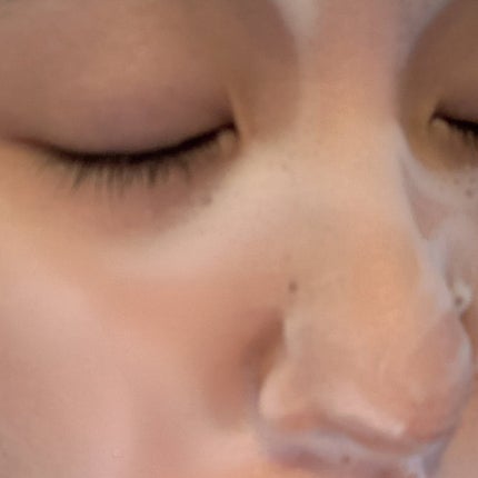 薬用化粧水/スキンライフ/化粧水を使ったクチコミ(5枚目)