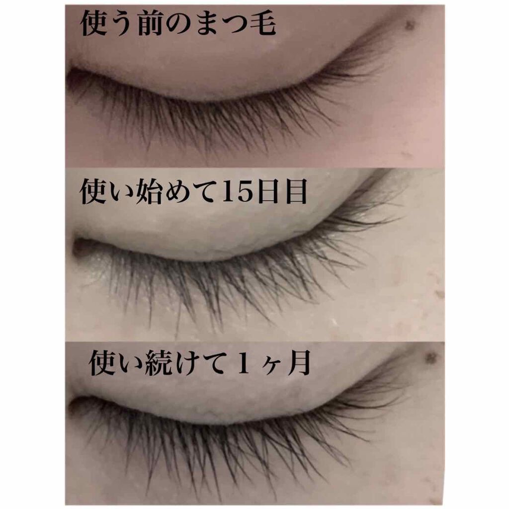 スカルプD ボーテ ピュアフリーアイラッシュセラム/アンファー(スカルプD)/まつげ美容液を使ったクチコミ(2枚目)