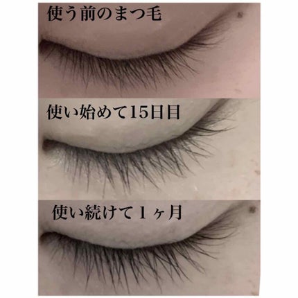 スカルプD ボーテ ピュアフリーアイラッシュセラム/アンファー(スカルプD)/まつげ美容液を使ったクチコミ(2枚目)