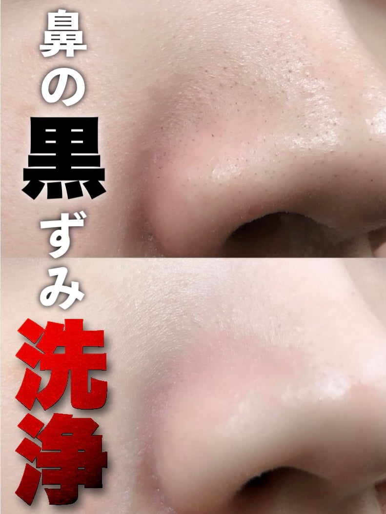 ダヴ 吸着毛穴ケア 洗顔ジェル/ダヴ/その他洗顔料を使ったクチコミ(1枚目)