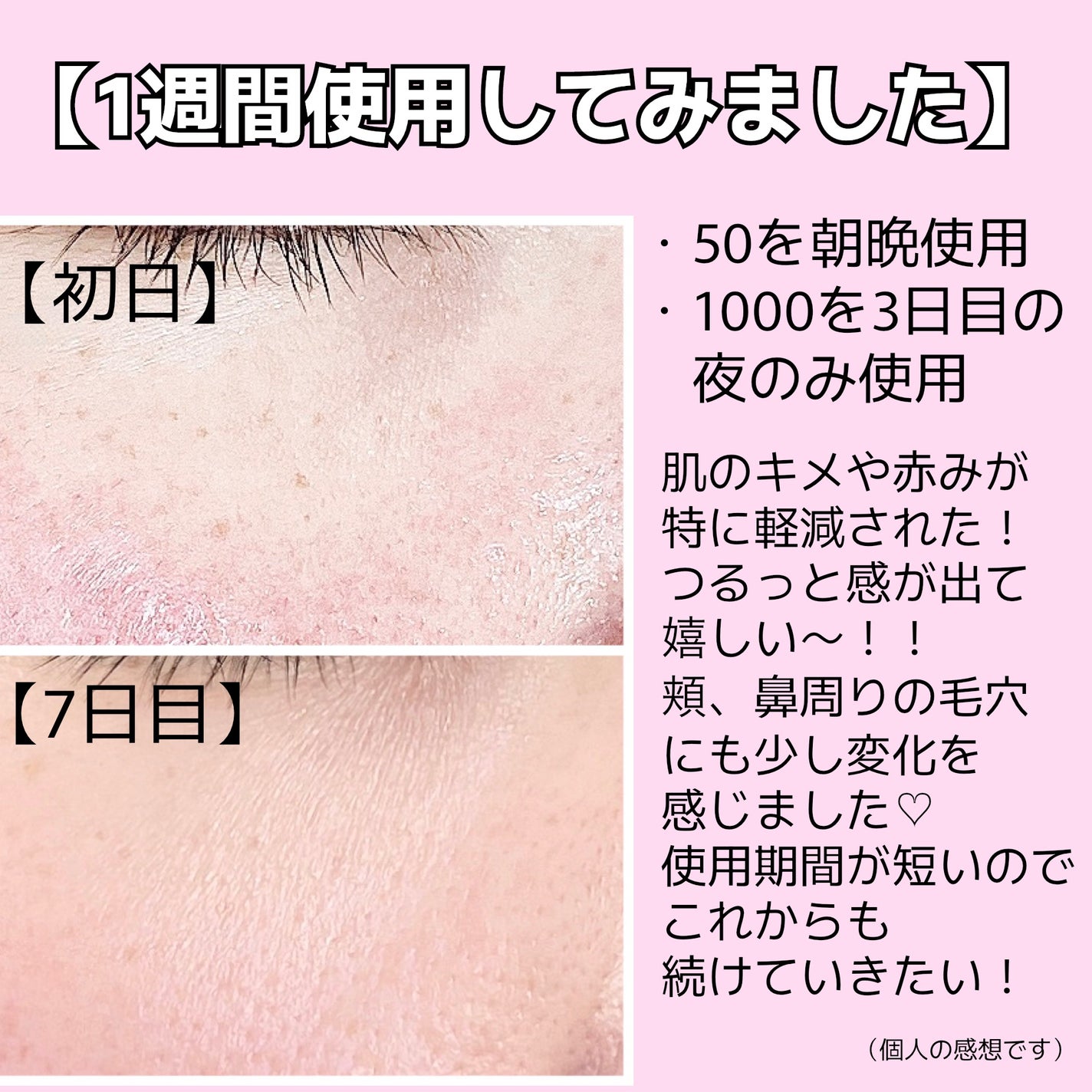 マイルドリードルショット50/VT/美容液を使ったクチコミ(5枚目)